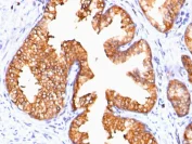 Immunohistochemistry (Formalin/PFA-fixed paraffin-embedded sections) - Anti-Ornithine Decarboxylase/ODC antibody [ODC1/485] (AB193338)
