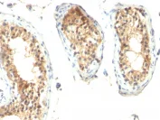 Immunohistochemistry (Formalin/PFA-fixed paraffin-embedded sections) - Anti-Ornithine Decarboxylase/ODC antibody [ODC1/485] (AB193338)