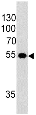 Western blot - Anti-Ornithine Decarboxylase/ODC antibody [ODC1/485] (AB193338)