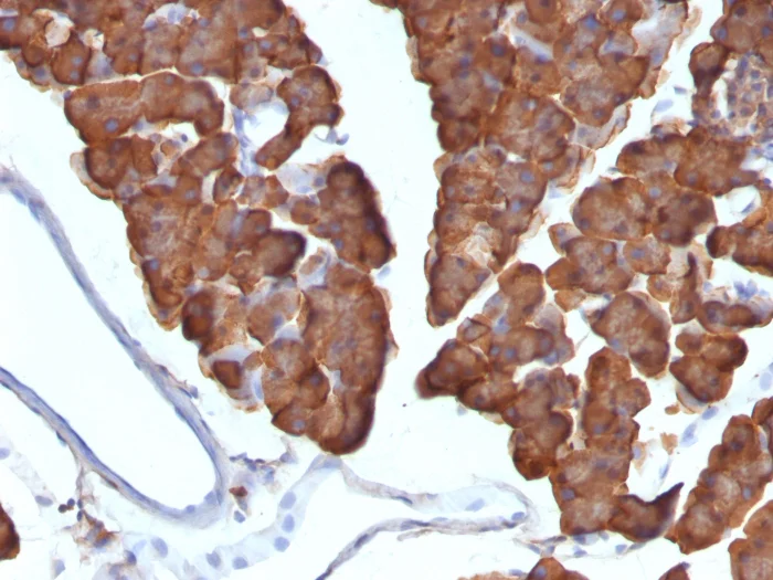 Immunohistochemistry (Formalin/PFA-fixed paraffin-embedded sections) - Anti-Ornithine Decarboxylase/ODC antibody [ODC1/487] (AB220205)