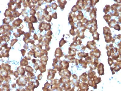 Immunohistochemistry (Formalin/PFA-fixed paraffin-embedded sections) - Anti-Ornithine Decarboxylase/ODC antibody [ODC1/487] (AB220205)