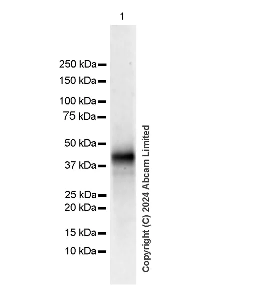 Western blot - Anti-Orosomucoid 1 + Orosomucoid 2 antibody [EPR26603-6] (AB322041)