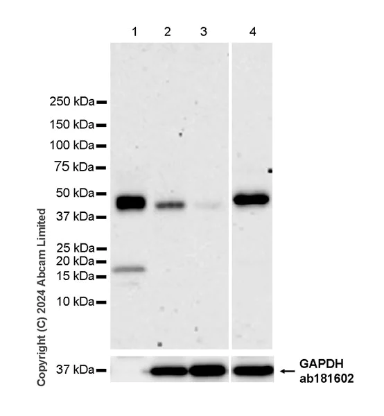 Western blot - Anti-Orosomucoid 1 + Orosomucoid 2 antibody [EPR26603-6] (AB322041)