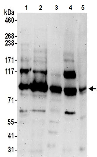 Western blot - Anti-ORP-11 antibody - N-terminal (AB194957)