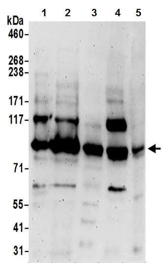 Western blot - Anti-ORP-11 antibody - N-terminal (AB194957)