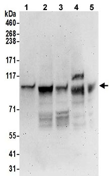 Western blot - Anti-ORP-3 antibody (AB192998)