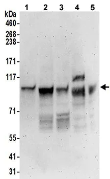Western blot - Anti-ORP-3 antibody (AB192998)