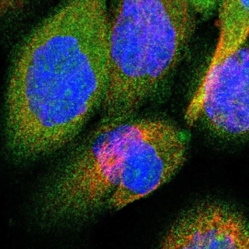 Immunocytochemistry/ Immunofluorescence - Anti-ORP-3 antibody (AB224212), expandable thumbnail