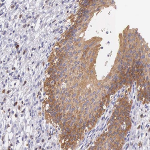 Immunohistochemistry (Formalin/PFA-fixed paraffin-embedded sections) - Anti-ORP-3 antibody (AB224212), expandable thumbnail