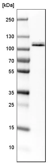 Western blot - Anti-ORP-3 antibody (AB224212)