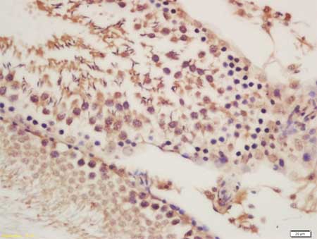 Immunohistochemistry (Formalin/PFA-fixed paraffin-embedded sections) - Anti-ORP1 antibody (AB203352)