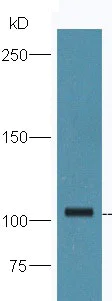 Western blot - Anti-ORP1 antibody (AB203352)