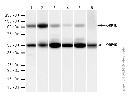 Western blot - Anti-ORP1 antibody [EPR8646] (AB131165)