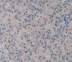 Immunohistochemistry (Formalin/PFA-fixed paraffin-embedded sections) - Anti-ORP150 antibody (AB232902)