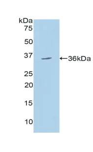 Western blot - Anti-ORP150 antibody (AB232902)