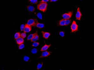 Immunocytochemistry/ Immunofluorescence - Anti-ORP150 antibody [EP5891] (AB134944)