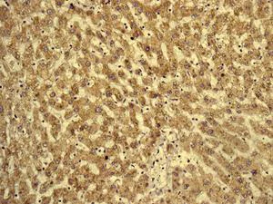 Immunohistochemistry (Formalin/PFA-fixed paraffin-embedded sections) - Anti-ORP150 antibody [EP5891] (AB134944)