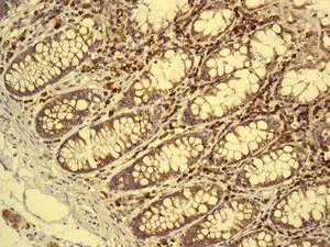 Immunohistochemistry (Formalin/PFA-fixed paraffin-embedded sections) - Anti-ORP150 antibody [EP5891] (AB134944)