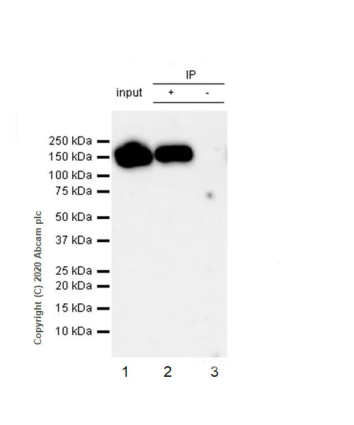 Immunoprecipitation - Anti-ORP150 antibody [EP5891] (AB134944)