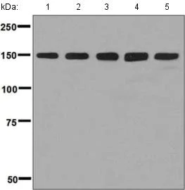 Western blot - Anti-ORP150 antibody [EP5891] (AB134944)
