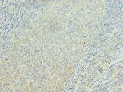 Immunohistochemistry (Formalin/PFA-fixed paraffin-embedded sections) - Anti-ORP2 antibody (AB235298)