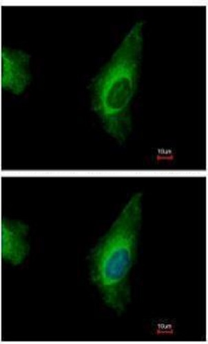 Immunocytochemistry/ Immunofluorescence - Anti-ORP8 antibody (AB228990)