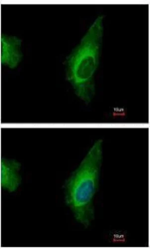 Immunocytochemistry/ Immunofluorescence - Anti-ORP8 antibody (AB228990)