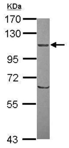 Western blot - Anti-ORP8 antibody (AB228990)