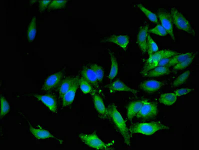 Immunocytochemistry/ Immunofluorescence - Anti-OS9 antibody (AB225915)