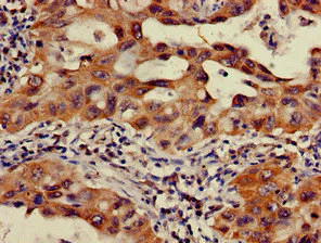 Immunohistochemistry (Formalin/PFA-fixed paraffin-embedded sections) - Anti-OS9 antibody (AB225915)