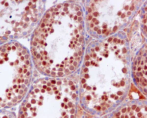 Immunohistochemistry (Formalin/PFA-fixed paraffin-embedded sections) - Anti-OS9 antibody [EPR4272(2)] (AB109510)