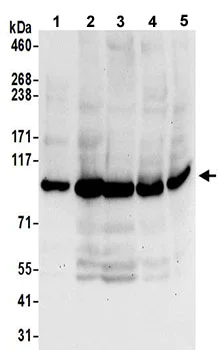 Western blot - Anti-OSBP1 antibody (AB192995)