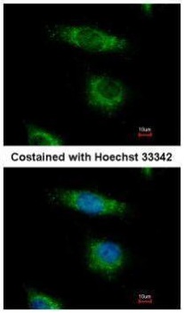 Immunocytochemistry/ Immunofluorescence - Anti-OSBPL5/ORP5 antibody (AB127171), expandable thumbnail