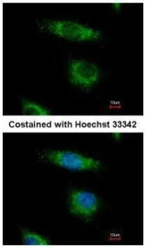 Immunocytochemistry/ Immunofluorescence - Anti-OSBPL5/ORP5 antibody (AB127171)