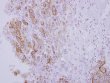 Immunohistochemistry (Formalin/PFA-fixed paraffin-embedded sections) - Anti-OSBPL5/ORP5 antibody (AB127171), expandable thumbnail