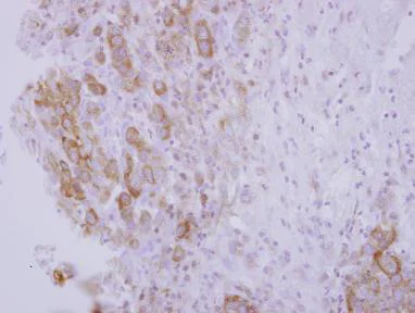 Immunohistochemistry (Formalin/PFA-fixed paraffin-embedded sections) - Anti-OSBPL5/ORP5 antibody (AB127171)