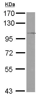 Western blot - Anti-OSBPL5/ORP5 antibody (AB127171)