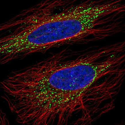 Immunocytochemistry/ Immunofluorescence - Anti-OSBPL5/ORP5 antibody (AB220143)