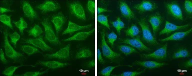 Immunocytochemistry/ Immunofluorescence - Anti-OSBPL6 antibody (AB96286)