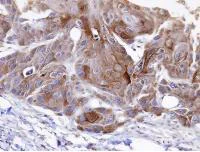 Immunohistochemistry (Formalin/PFA-fixed paraffin-embedded sections) - Anti-OSBPL6 antibody (AB96286)