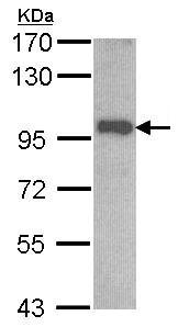 Western blot - Anti-OSBPL6 antibody (AB96286), expandable thumbnail