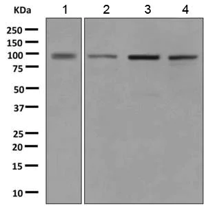Western blot - Anti-OSBPL9 antibody [EPR9333] (AB151691)