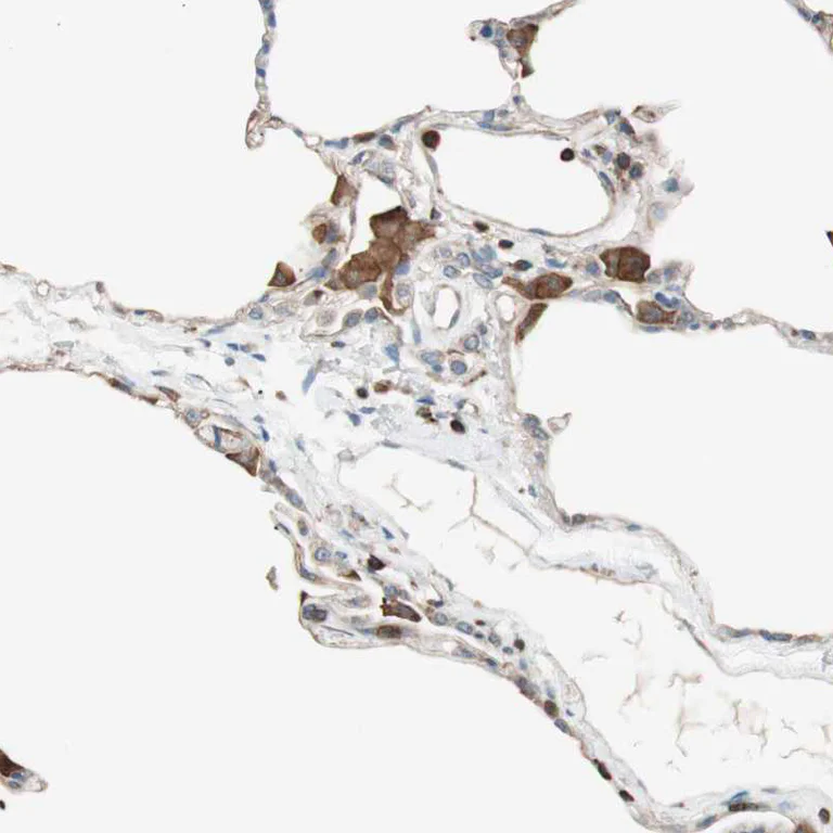 Immunohistochemistry (Formalin/PFA-fixed paraffin-embedded sections) - Anti-OSCP antibody (AB251678)