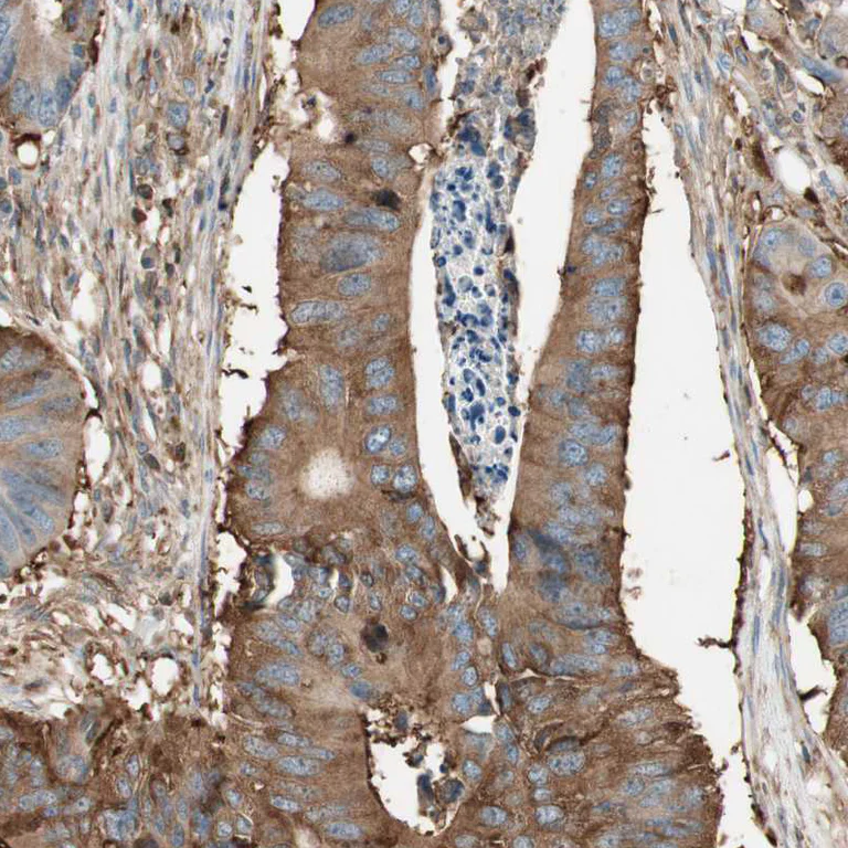 Immunohistochemistry (Formalin/PFA-fixed paraffin-embedded sections) - Anti-OSCP antibody (AB251678)