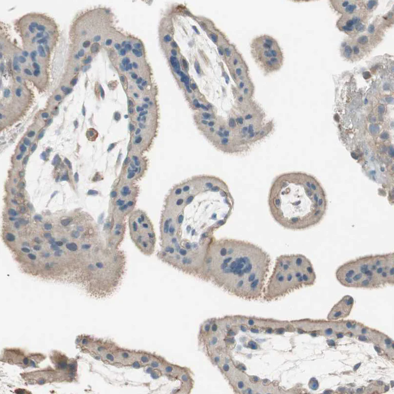 Immunohistochemistry (Formalin/PFA-fixed paraffin-embedded sections) - Anti-OSCP antibody (AB251678)