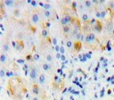 Immunohistochemistry (Formalin/PFA-fixed paraffin-embedded sections) - Anti-OSMR antibody (AB232684)