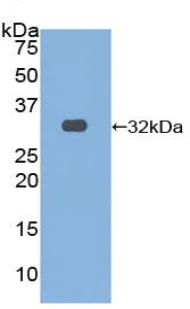 Western blot - Anti-OSMR antibody (AB232684)