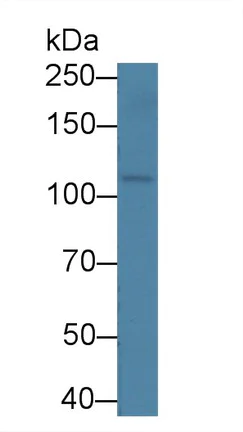 Western blot - Anti-OSMR antibody (AB232684)