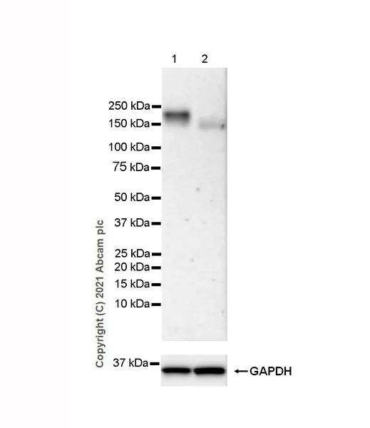 Western blot - Anti-OSMR antibody [EPR24611-71] (AB282577)