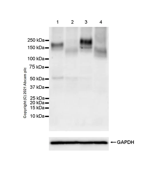 Western blot - Anti-OSMR antibody [EPR24611-71] (AB282577)